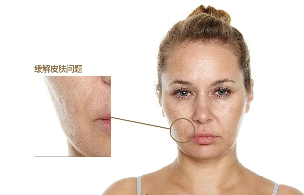 解析皮肤消失原因及解决步骤